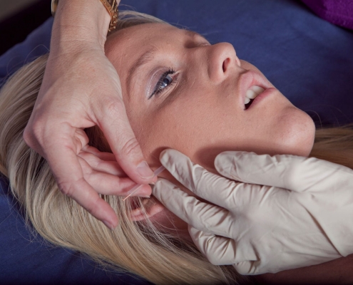 Dry Needling Jaw Robina