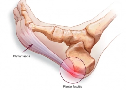 Foot Anatomy