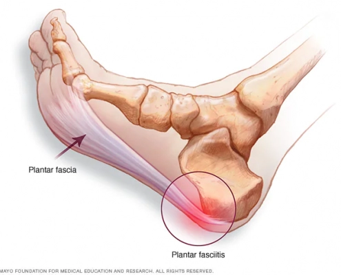 Foot Anatomy