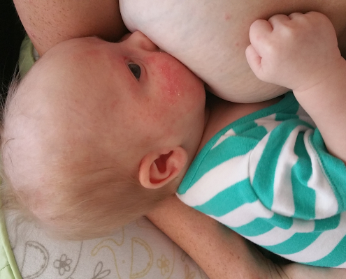 Baby Breastfeeding Mastitis