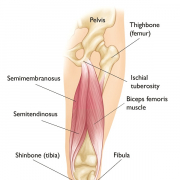 Hamstring Strains