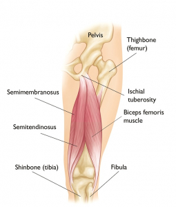 Hamstring Strains