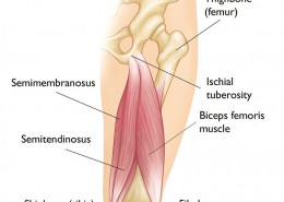 Hamstring Strains