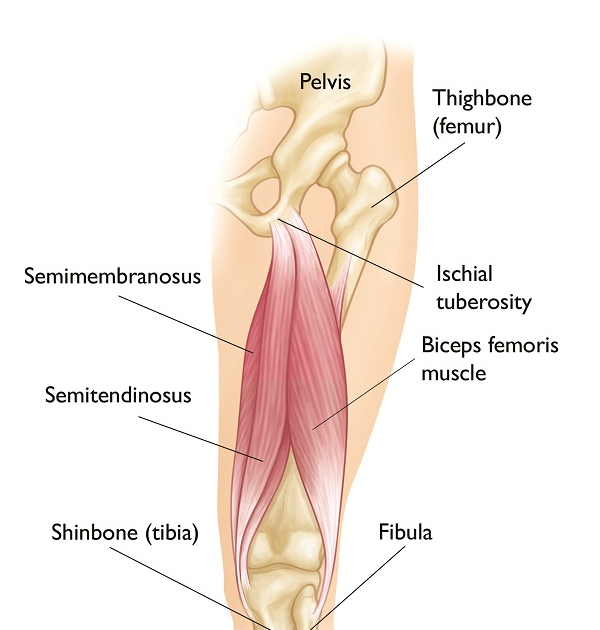 Hamstring Tears