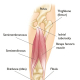 Hamstring Strains